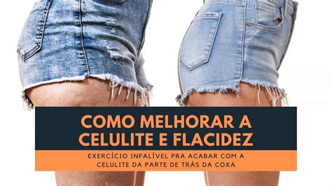 Como combater flacidez e celulite no bumbum